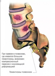 Pozvono4nik-217x300.png